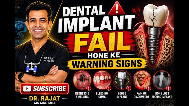 Why dental implants fail